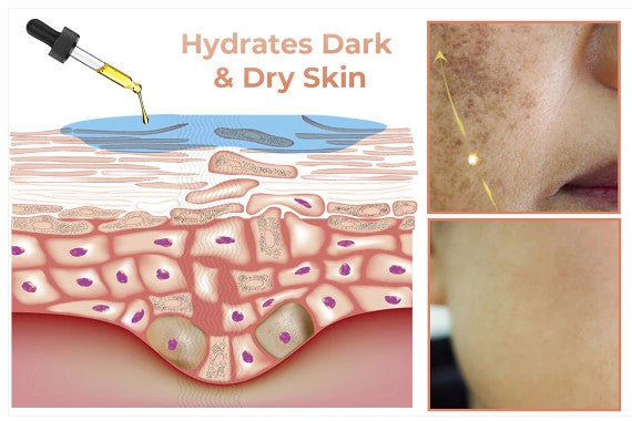 Gyors sötét foltokat eltávolító arcszérum a melanin korrekciójához