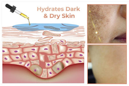 Gyors sötét foltokat eltávolító arcszérum a melanin korrekciójához