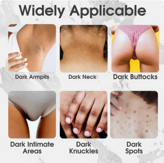 SnowBleach™ Fehérítő Testápoló Krém