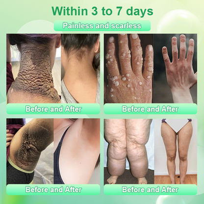 Hámló gél tisztító