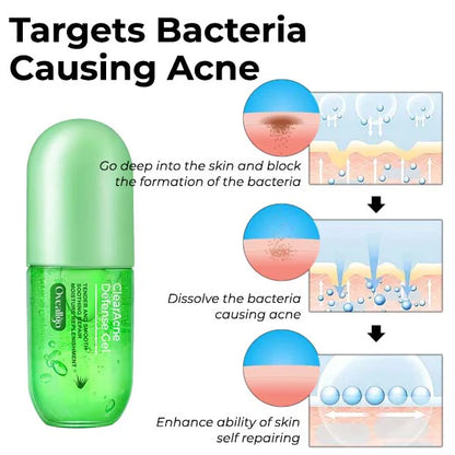 Gél pattanások és foltok ellen
