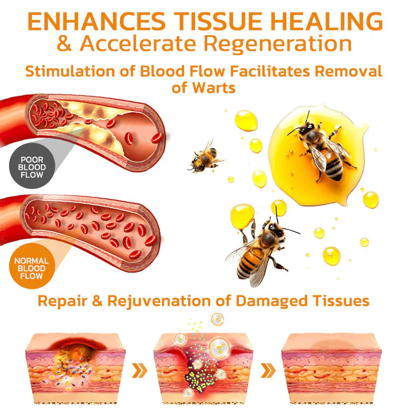 Méhméreg kezelő gél anyajegyekre és szemölcsökre