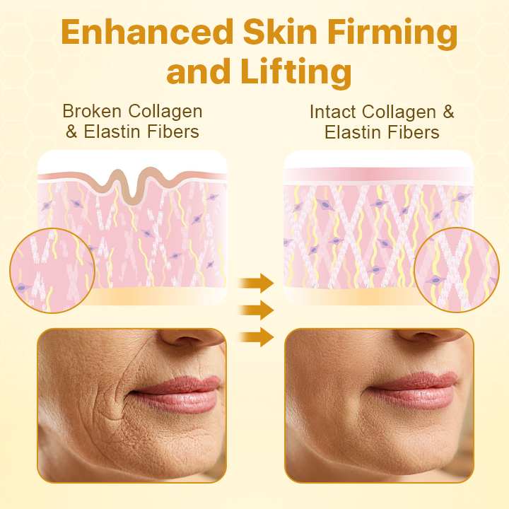 BotoxLax lifting krém méhméreggel