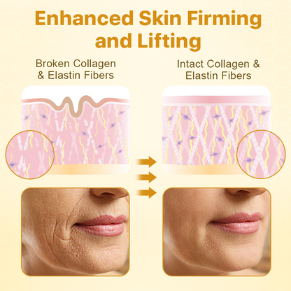 BotoxLax lifting krém méhméreggel