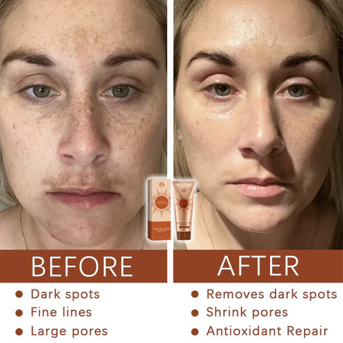 Gyógynövényes arcmaszk sötét foltokra