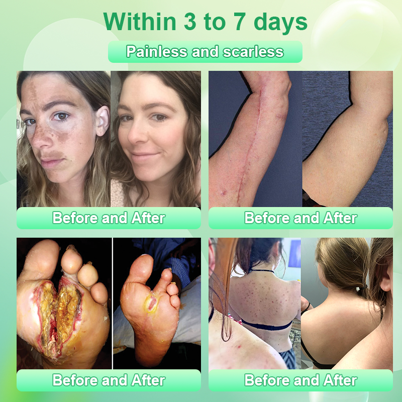 Hámló gél tisztító