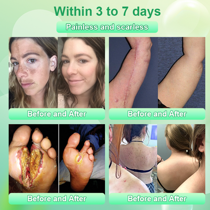 Hámló gél tisztító