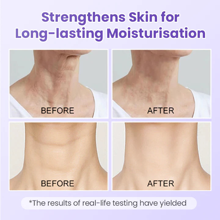 Ránctalanító nyaktapasz peptidekkel