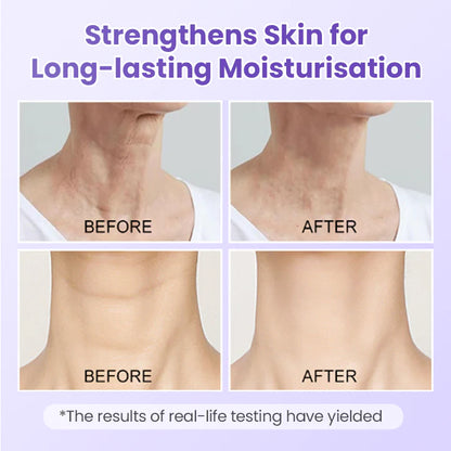 Ránctalanító nyaktapasz peptidekkel