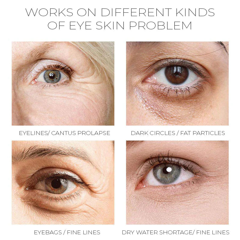 Tonizáló-hidratáló szemkörnyékápoló krémek kaviárral, aranykivonattal és ázsiai gázlóval a regenerálásért