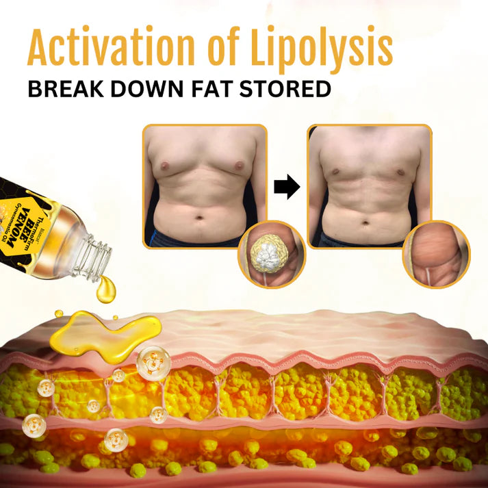 Gynecomastia olaj méhméreggel