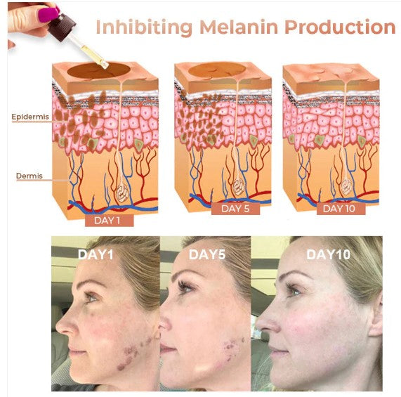Gyors sötét foltokat eltávolító arcszérum a melanin korrekciójához