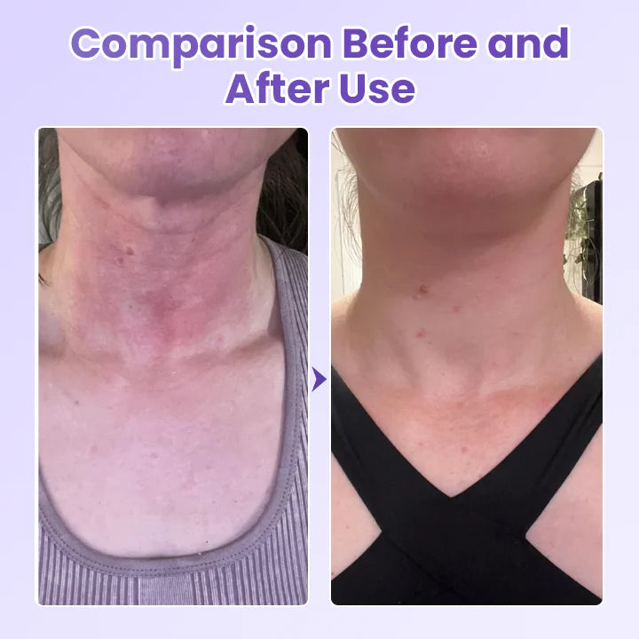 Ránctalanító nyaktapasz peptidekkel