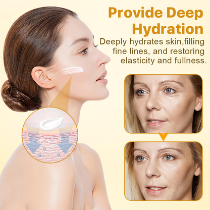 BotoxLax lifting krém méhméreggel