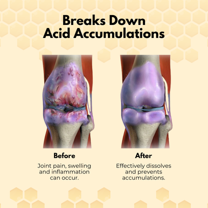 Ízületi kezelő tapaszok méhméreggel
