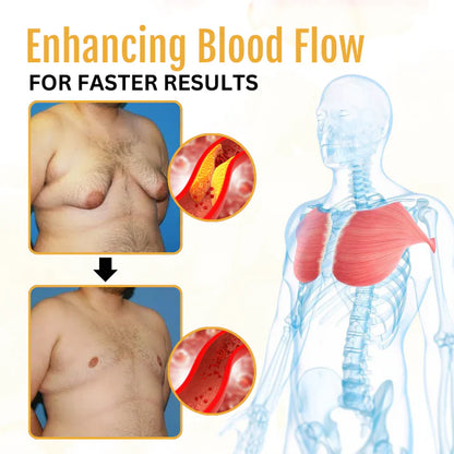 Gynecomastia olaj méhméreggel