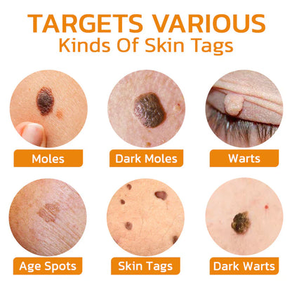 Méhméreg kezelő gél anyajegyekre és szemölcsökre