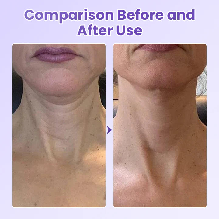 Ránctalanító nyaktapasz peptidekkel