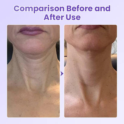 Ránctalanító nyaktapasz peptidekkel