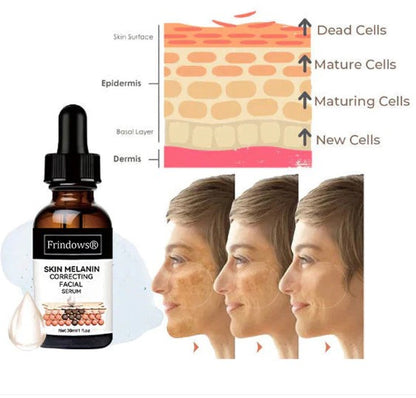 Gyors sötét foltokat eltávolító arcszérum a melanin korrekciójához