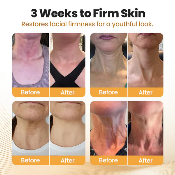 BeeLixir Nyakfeszesítő Stílus