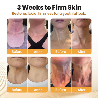 BeeLixir Nyakfeszesítő Stílus