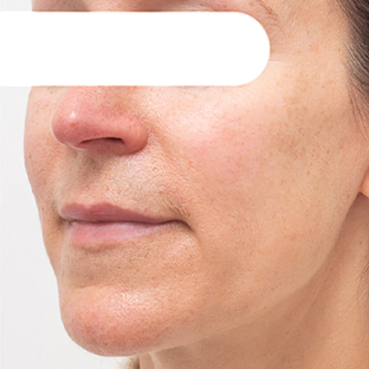 Gyógynövényes arcmaszk sötét foltokra