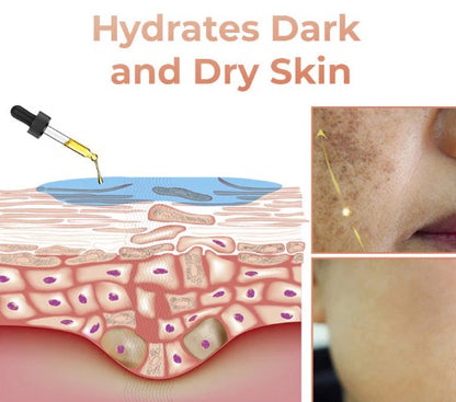 Gyors sötét foltokat eltávolító arcszérum a melanin korrekciójához