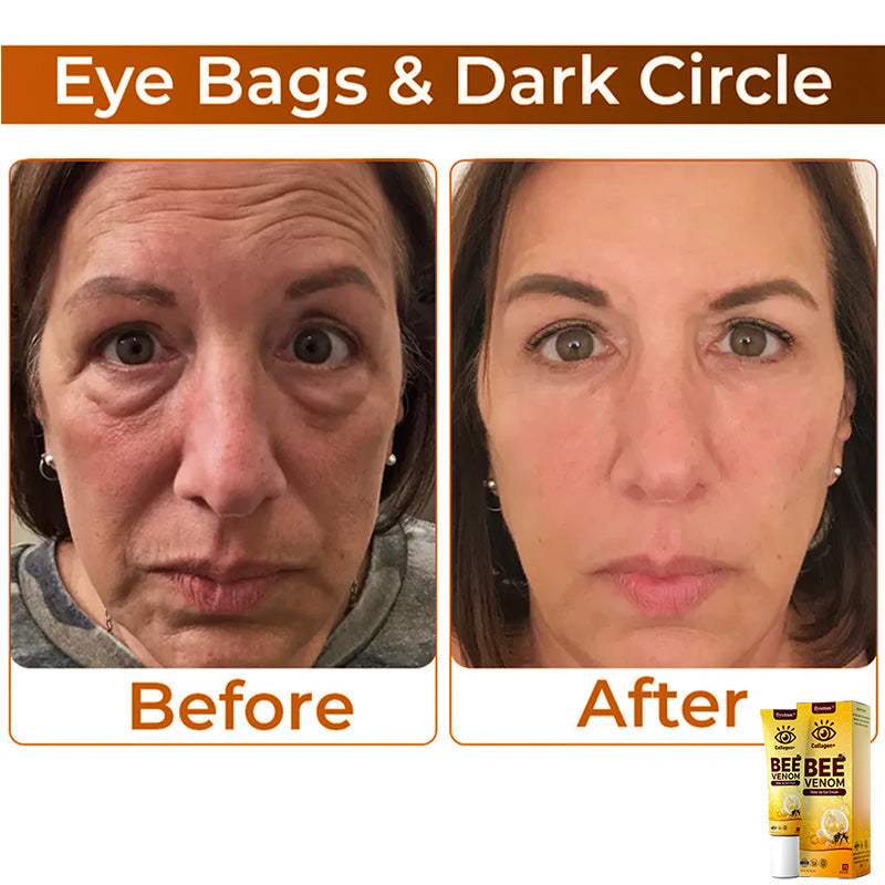 Bee Venom szemkörnyékápoló krém az öregedésgátláshoz és a lifting hatásért