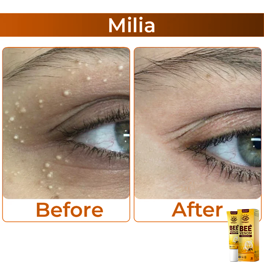 Bee Venom szemkörnyékápoló krém az öregedésgátláshoz és a lifting hatásért