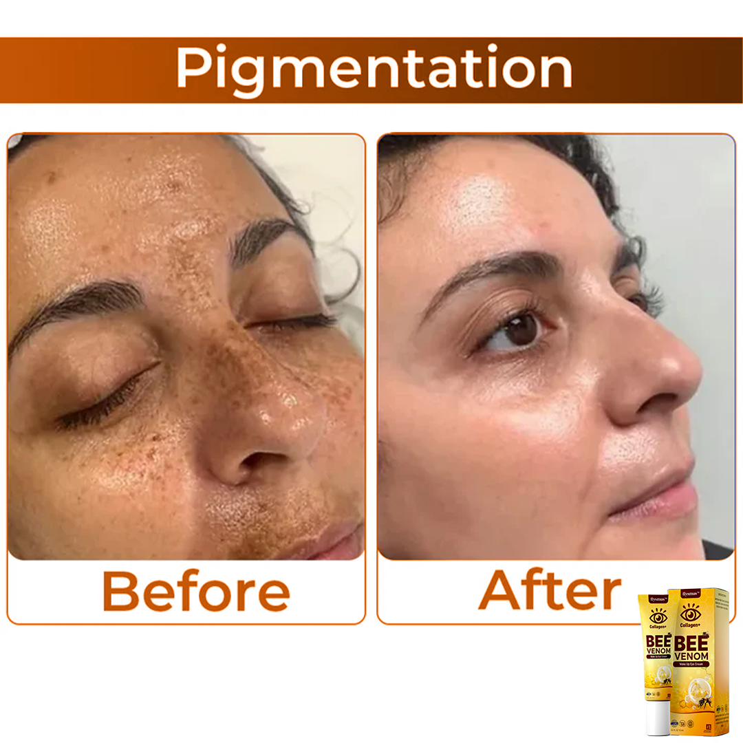 Bee Venom szemkörnyékápoló krém az öregedésgátláshoz és a lifting hatásért