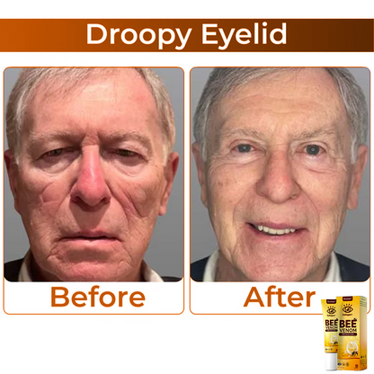 Bee Venom szemkörnyékápoló krém az öregedésgátláshoz és a lifting hatásért