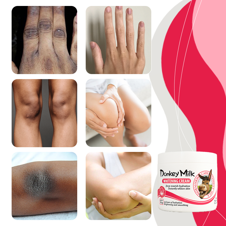 SnowBleach™ Fehérítő Testápoló Krém