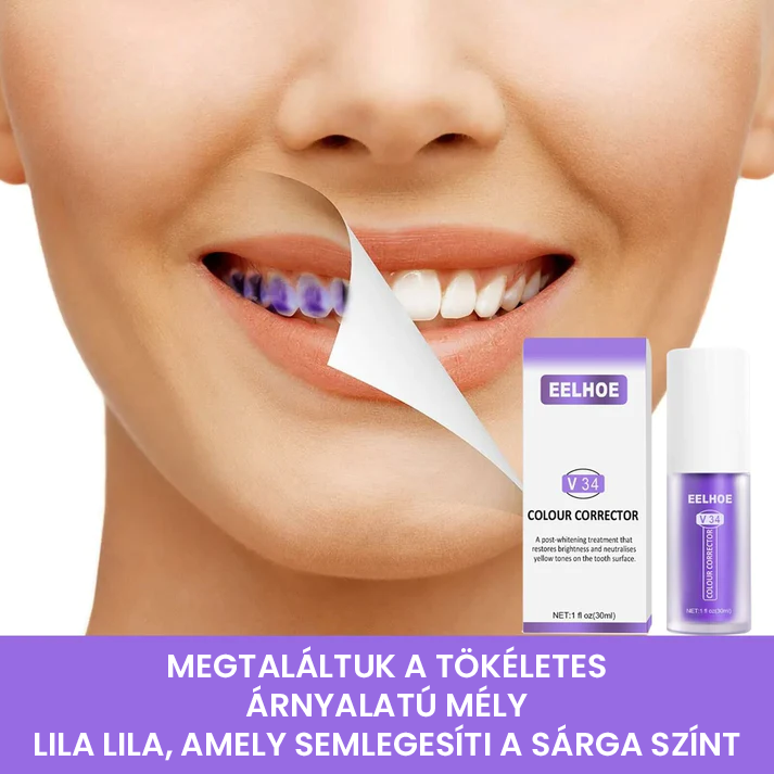 Fogszínkorrektor és zománcápoló szérum ✨