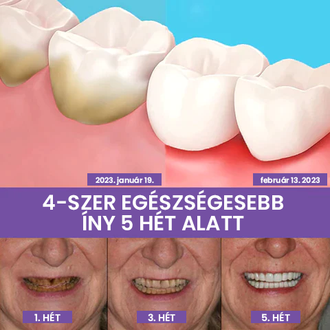 Fogszínkorrektor és zománcápoló szérum ✨