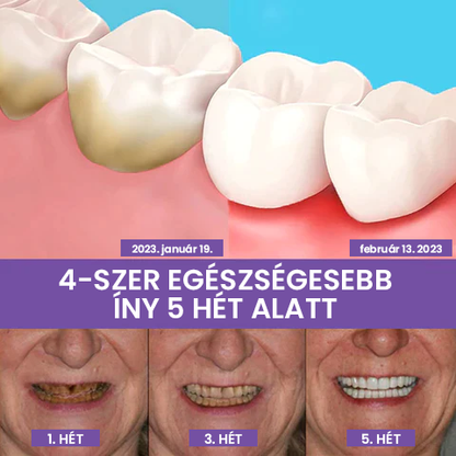 Fogszínkorrektor és zománcápoló szérum ✨