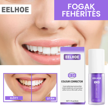 Fogszínkorrektor és zománcápoló szérum ✨