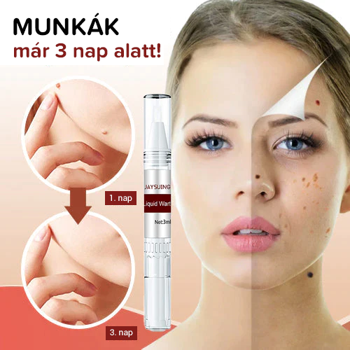 Folyékony szemölcs krém a bőrszemölcsök eltávolítására🌟🌟