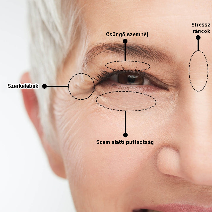 Azonnali szemfeszesítő krém!