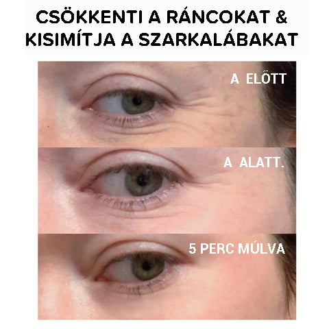 Azonnali szemfeszesítő krém!