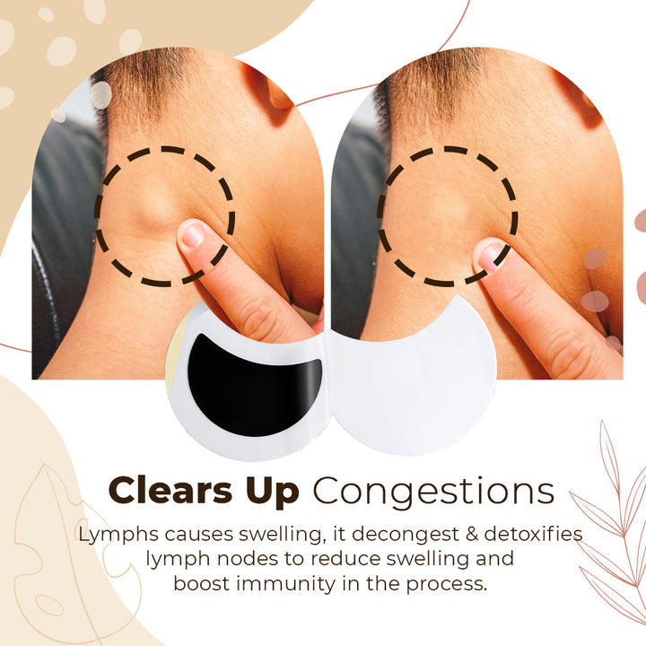 Tapasz a nyirokrendszer méregtelenítéséhez!