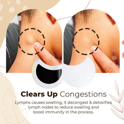 Tapasz a nyirokrendszer méregtelenítéséhez!