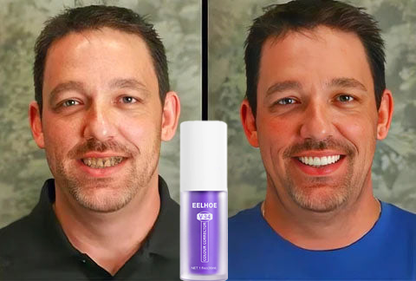 Fogszínkorrektor és zománcápoló szérum ✨