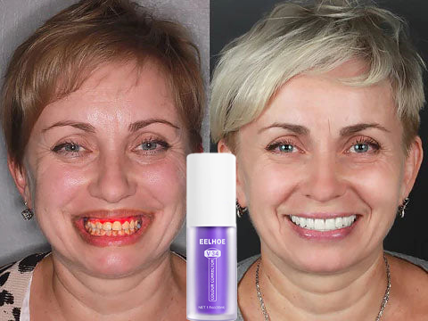 Fogszínkorrektor és zománcápoló szérum ✨