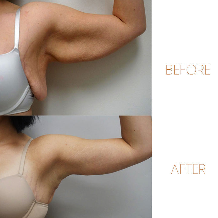 Gyógynövényolajok a nyirokrendszer méregtelenítésére és tisztítására