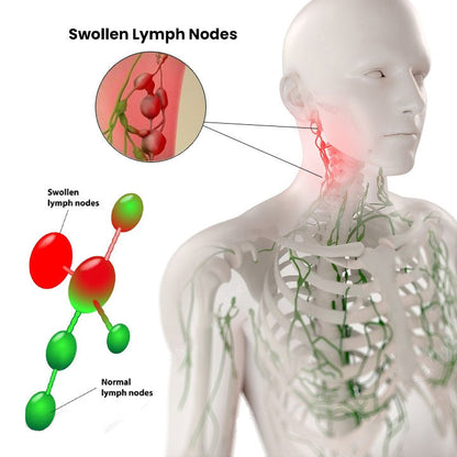 Gyógynövényolajok a nyirokrendszer méregtelenítésére és tisztítására