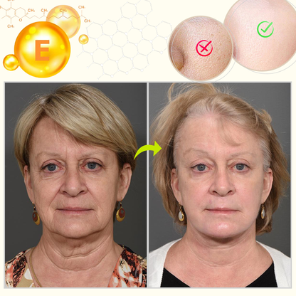 arcszérum E-vitaminnal 180 kapszulában